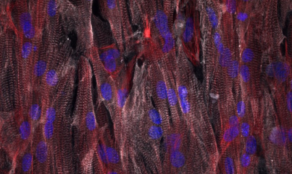 cardiac-tissue-Harvard-University-1020x610